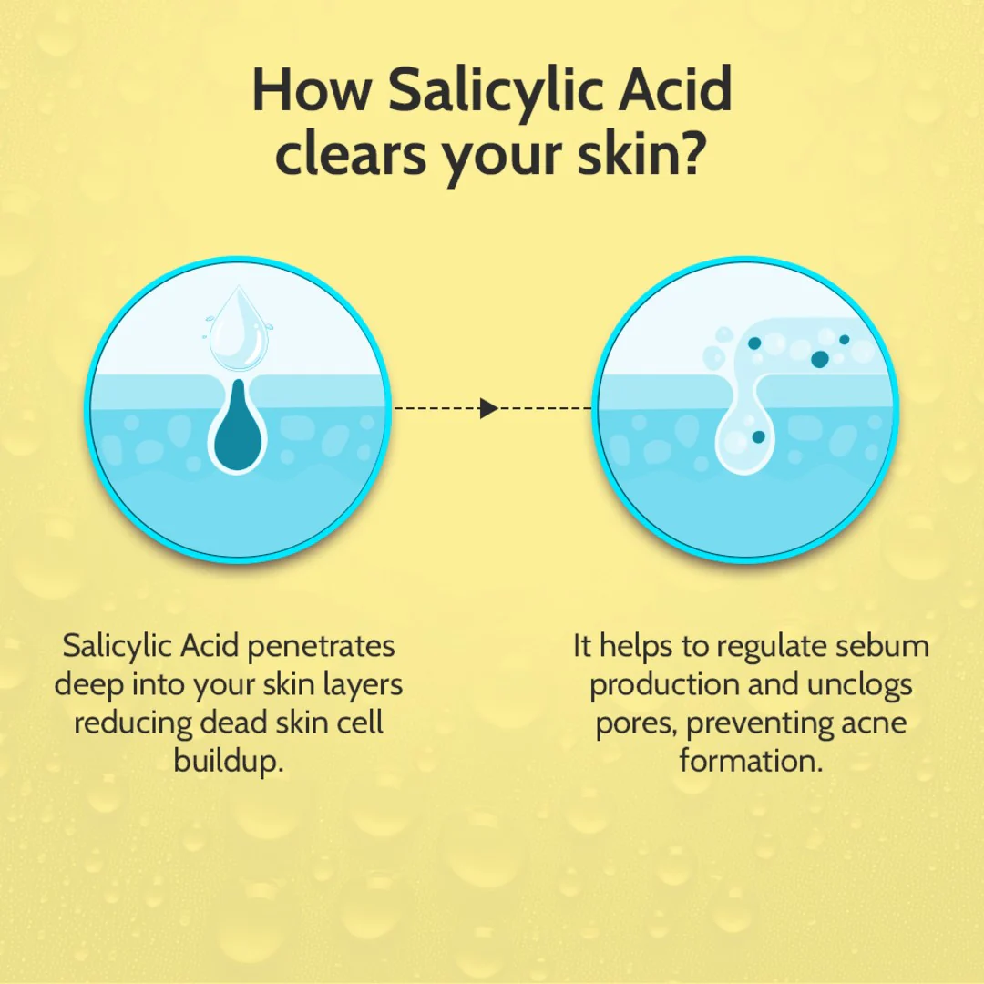 2% Salicylic Acid Face Serum for Acne Control - 30 ml - Image 8