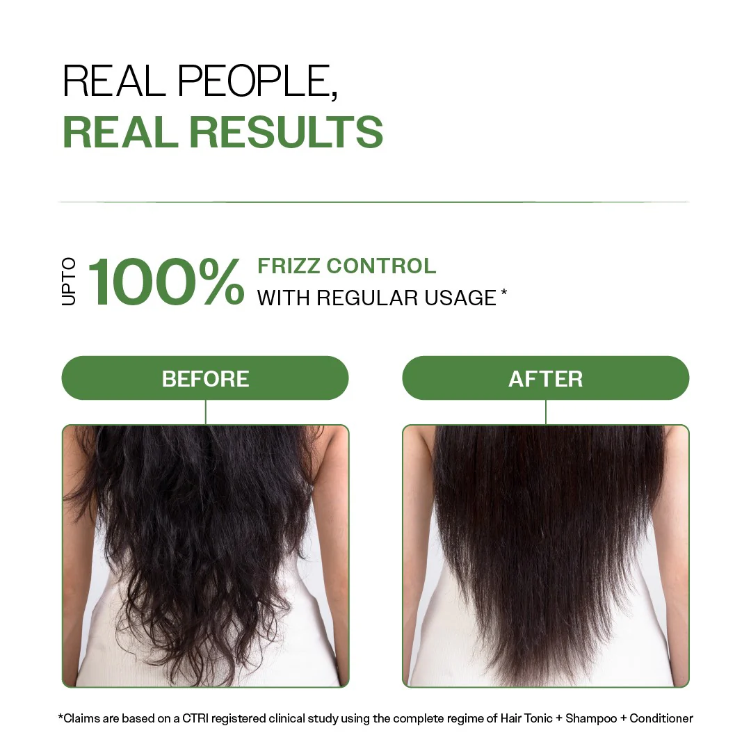 Anti-Dandruff Hair Conditioner with Salicylic Acid, Biotin & Rosemary - 175 gm - Image 6