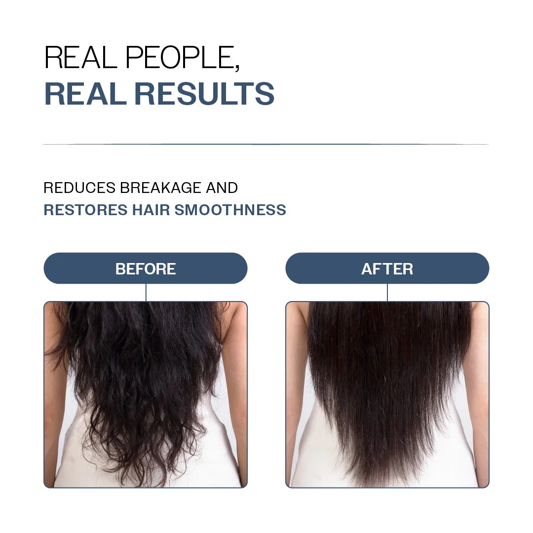 Anti-Hair Fall Conditioner with Redensyl, Rosemary & Peptides for Hair fall & Thinning - 175 gm - Image 5