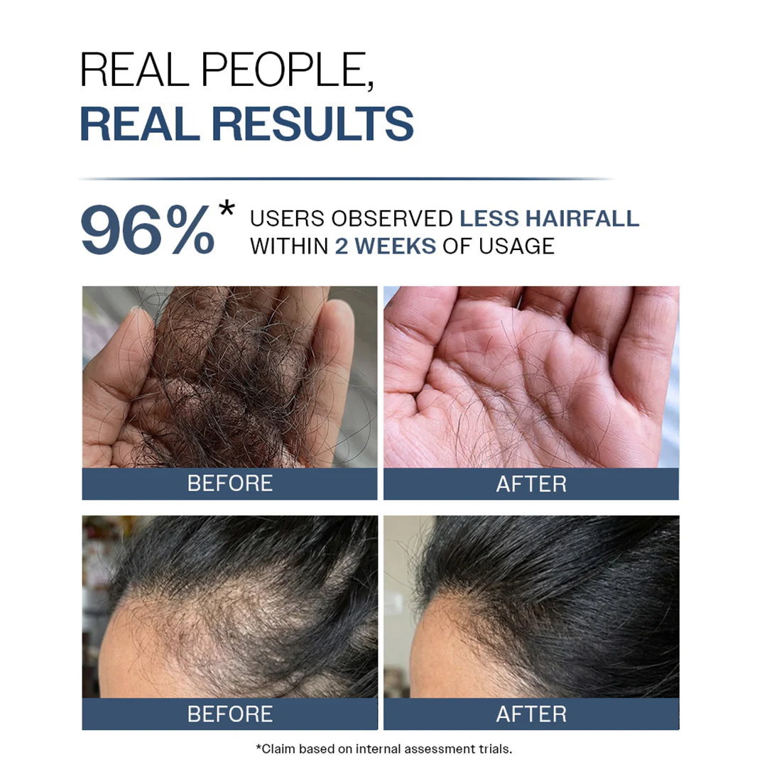 Anti-Hair Fall Shampoo with Adenosine & Peptides - 750 ml - Image 4