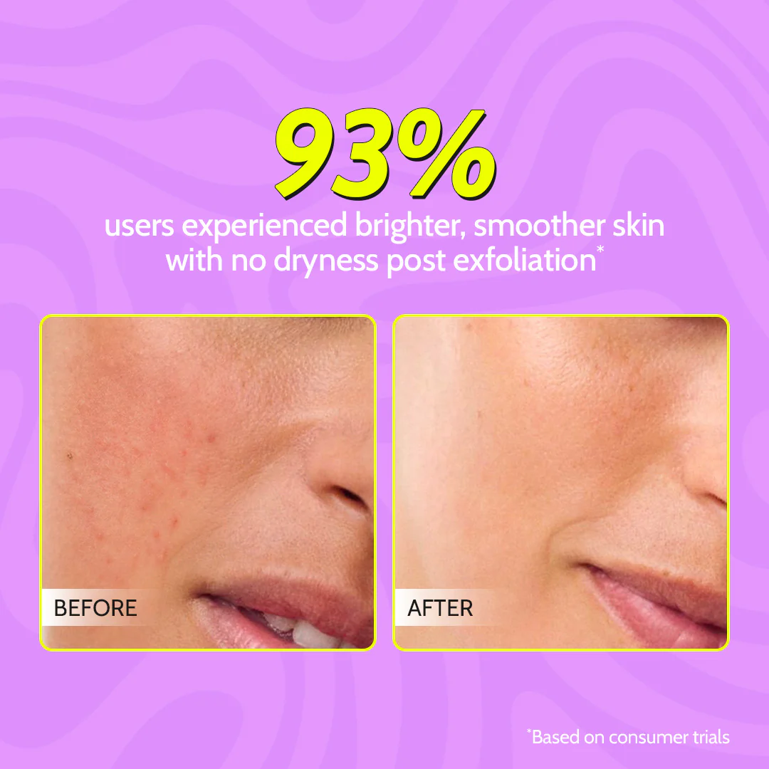 Complete Exfoliation Duo (Gentle Exfoliating Face Scrub - 100 ml | Exfoliating Body Scrub - 75 gm) - Image 5