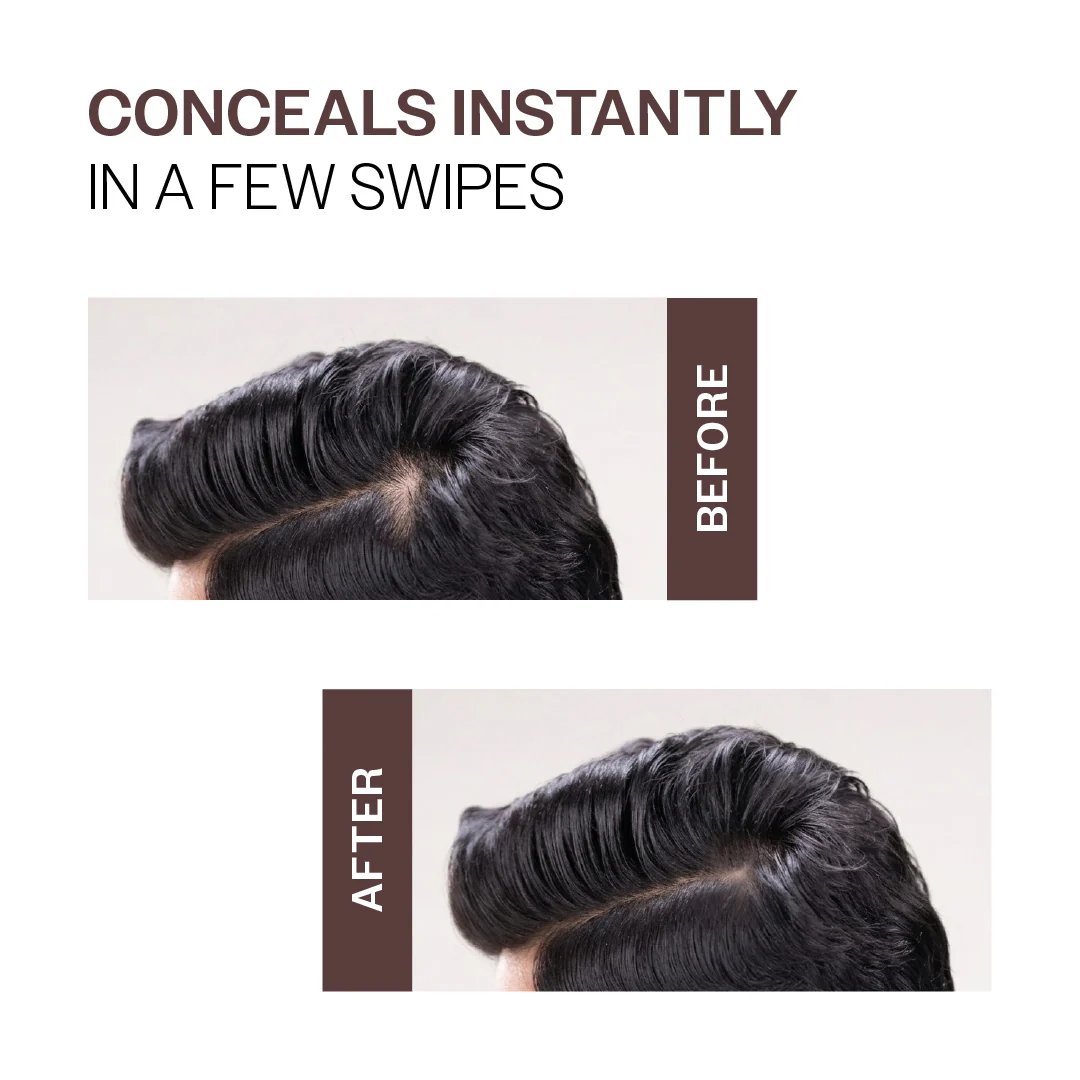 Instant Hair Cover-Up Powder (Brown Color) - 4 gm - Image 3