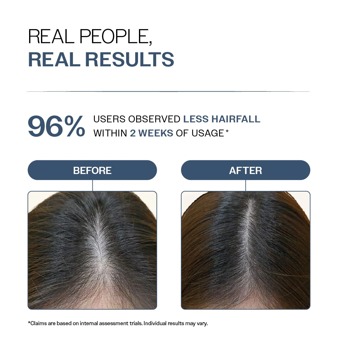 Anti-Hair Fall Shampoo with Adenosine & Peptides - 100 ml | Pack of 3 - Image 5