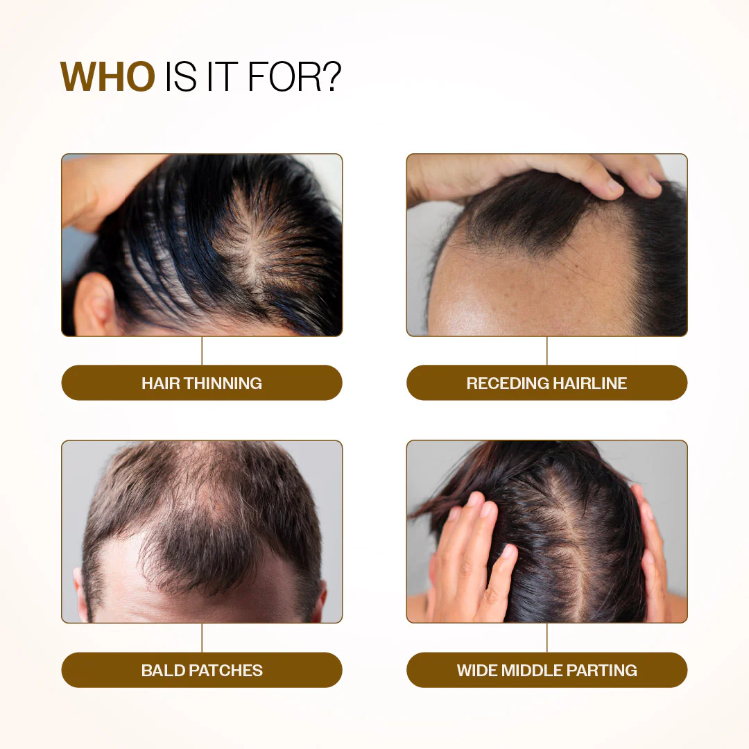 Clear Scalp Growth Pack (Hair Growth Serum Roll On - 25 ml | Anti-Dandruff Shampoo - 250 ml) - Image 5