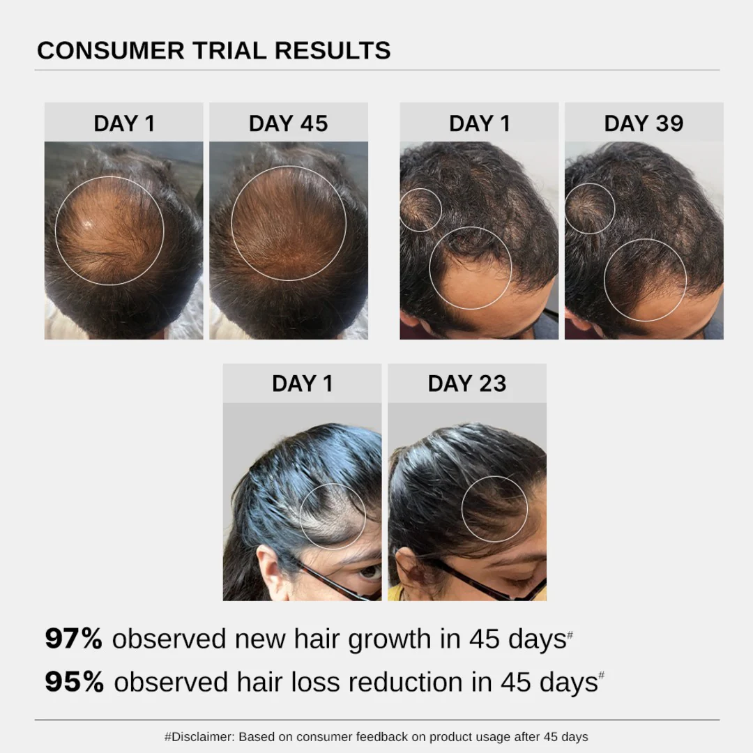 Hair Growth Serum (30 ml | Pack of 2) & Scalp Massager Hair Growth Combo - Image 6