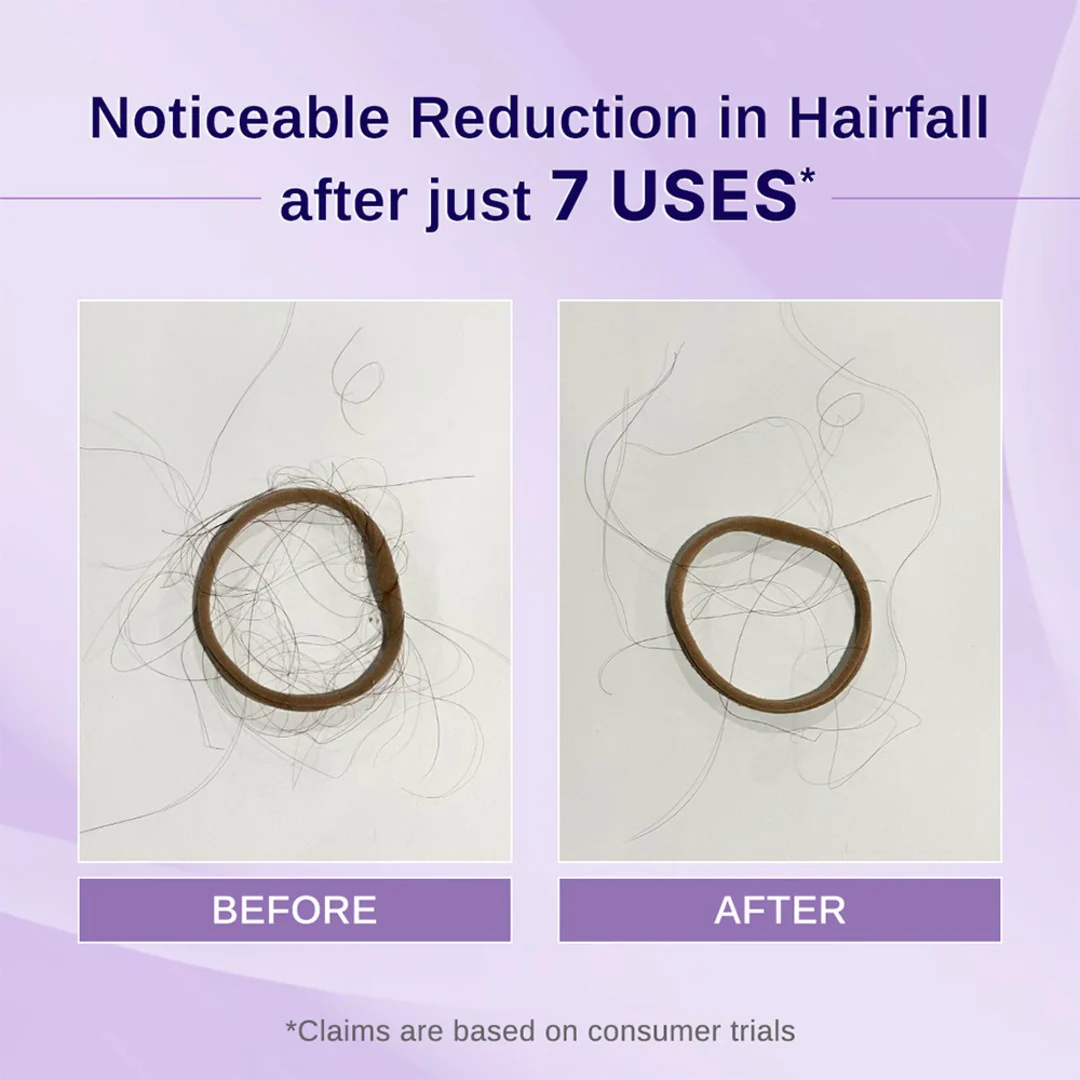 Rosemary & Hibiscus Hair Growth Oil with Redensyl & Biotin - 100 - Image 3