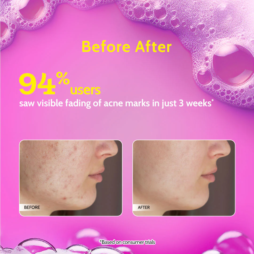 2% Salicylic Acid Face Wash for Acne & Oil Control - 100 ml - Image 5