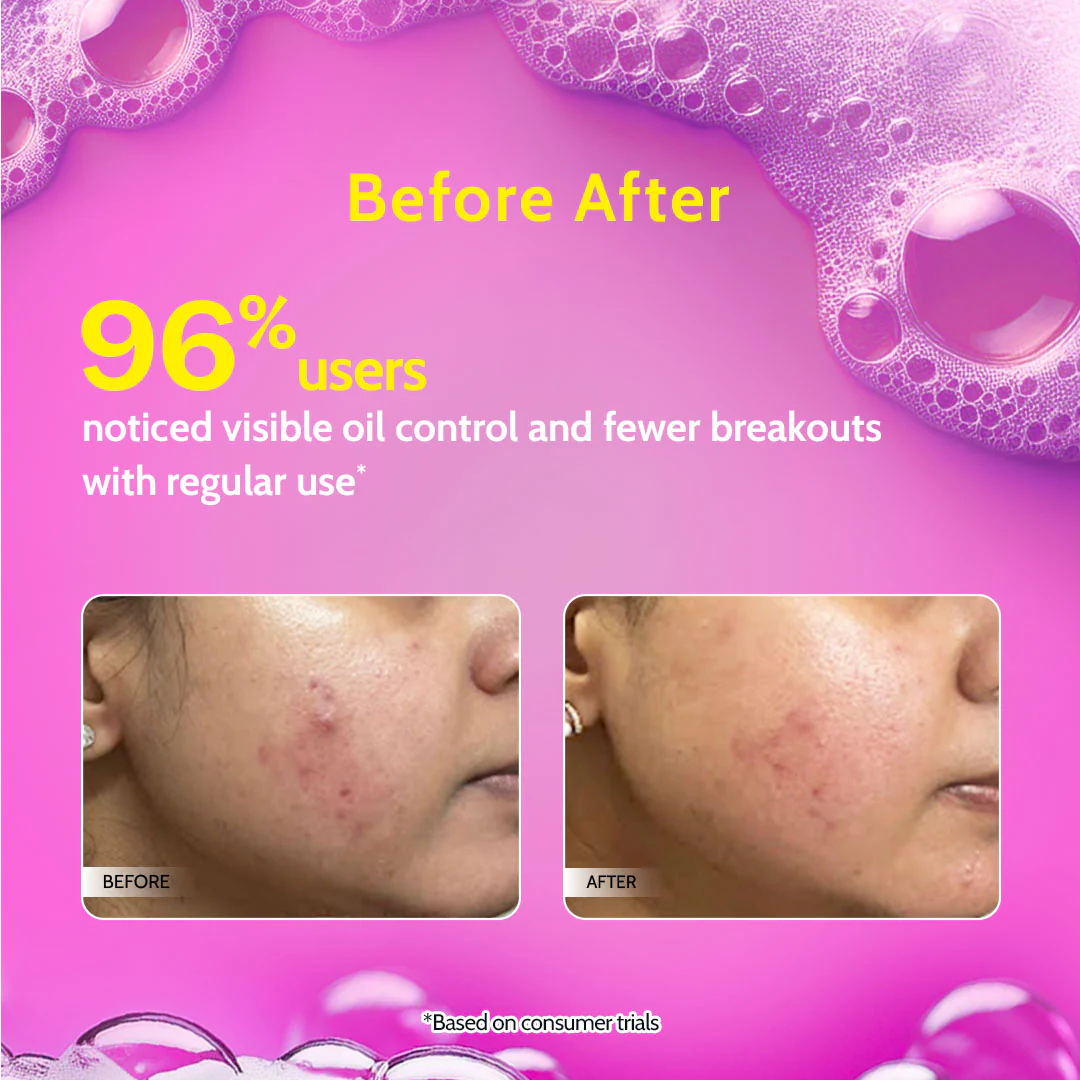 2% Salicylic Acid Face Wash for Acne & Oil Control - 100 ml - Image 6
